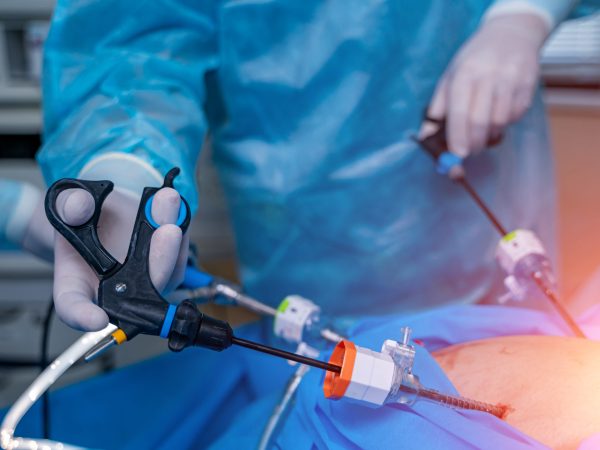 Surgery operation with modern equipment. Selective focus on doctor s hands with special robotic equipment.